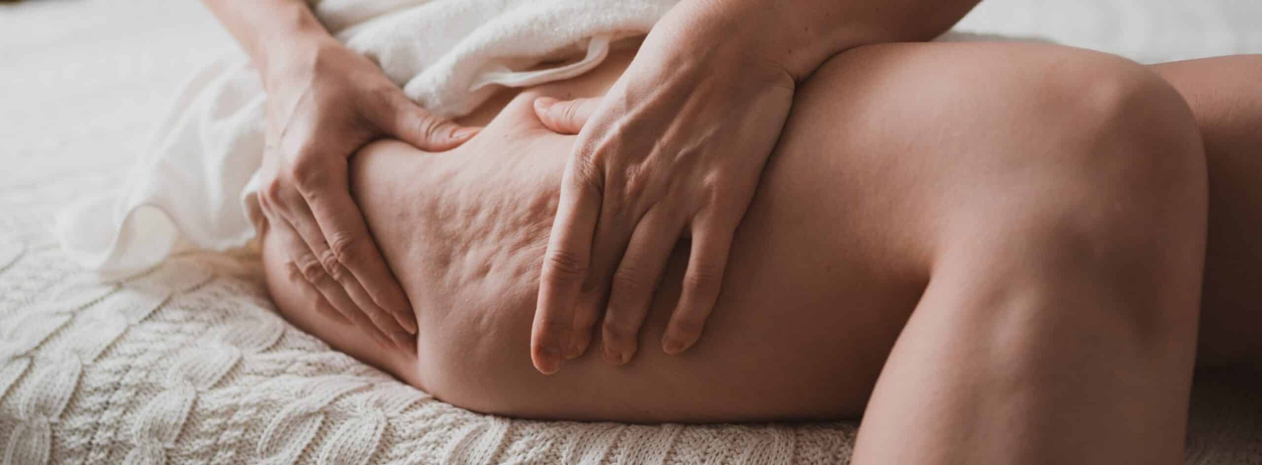 Les traitements anti-cellulite efficace en 2022 | Dr Christelle Santini | Paris