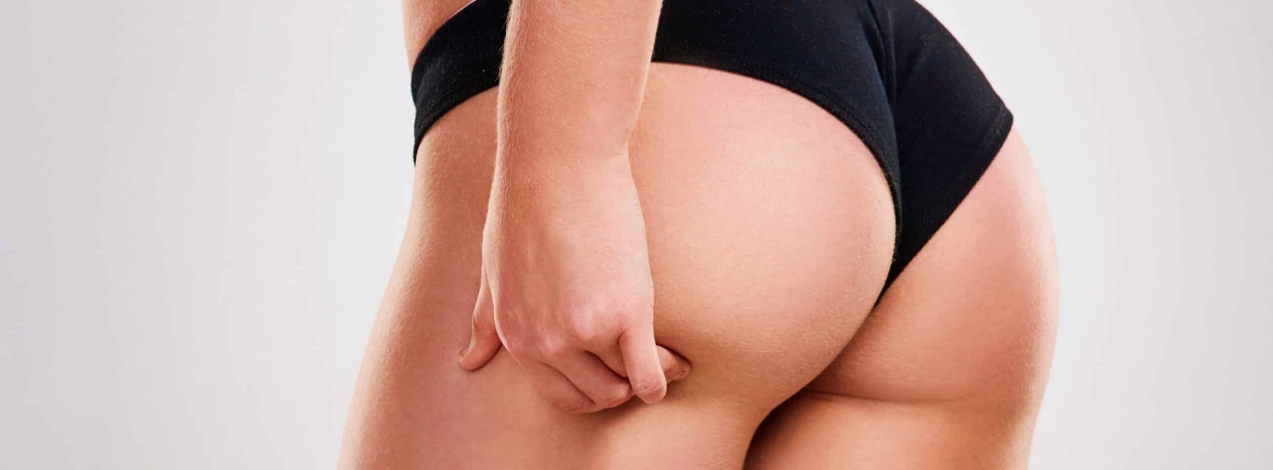 Comment obtenir des fesses plus volumineuses grâce à la chirurgie ? | Dr Christelle Santini | Paris