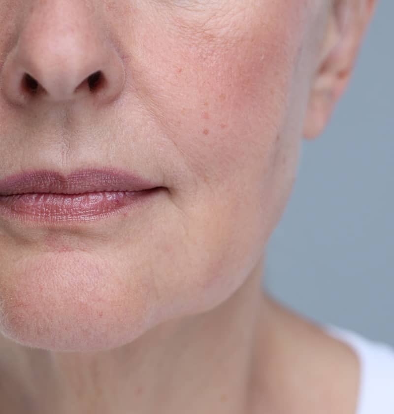 Comment remodeler des lèvres qui ont vieilli ? | Dr Christelle Santini | Paris
