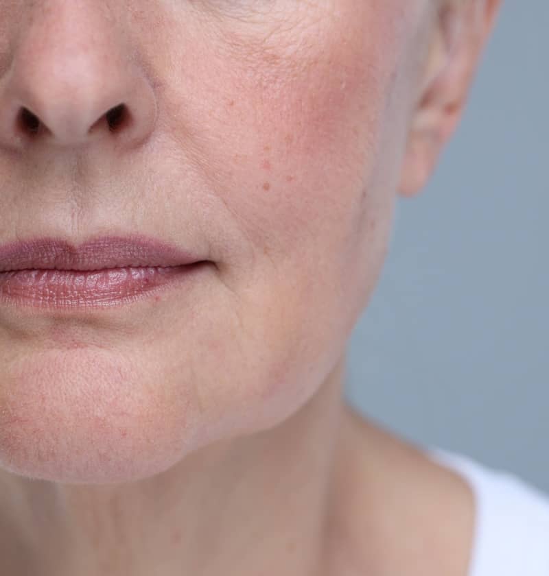 Comment remodeler des lèvres qui ont vieilli ? | Dr Christelle Santini | Paris