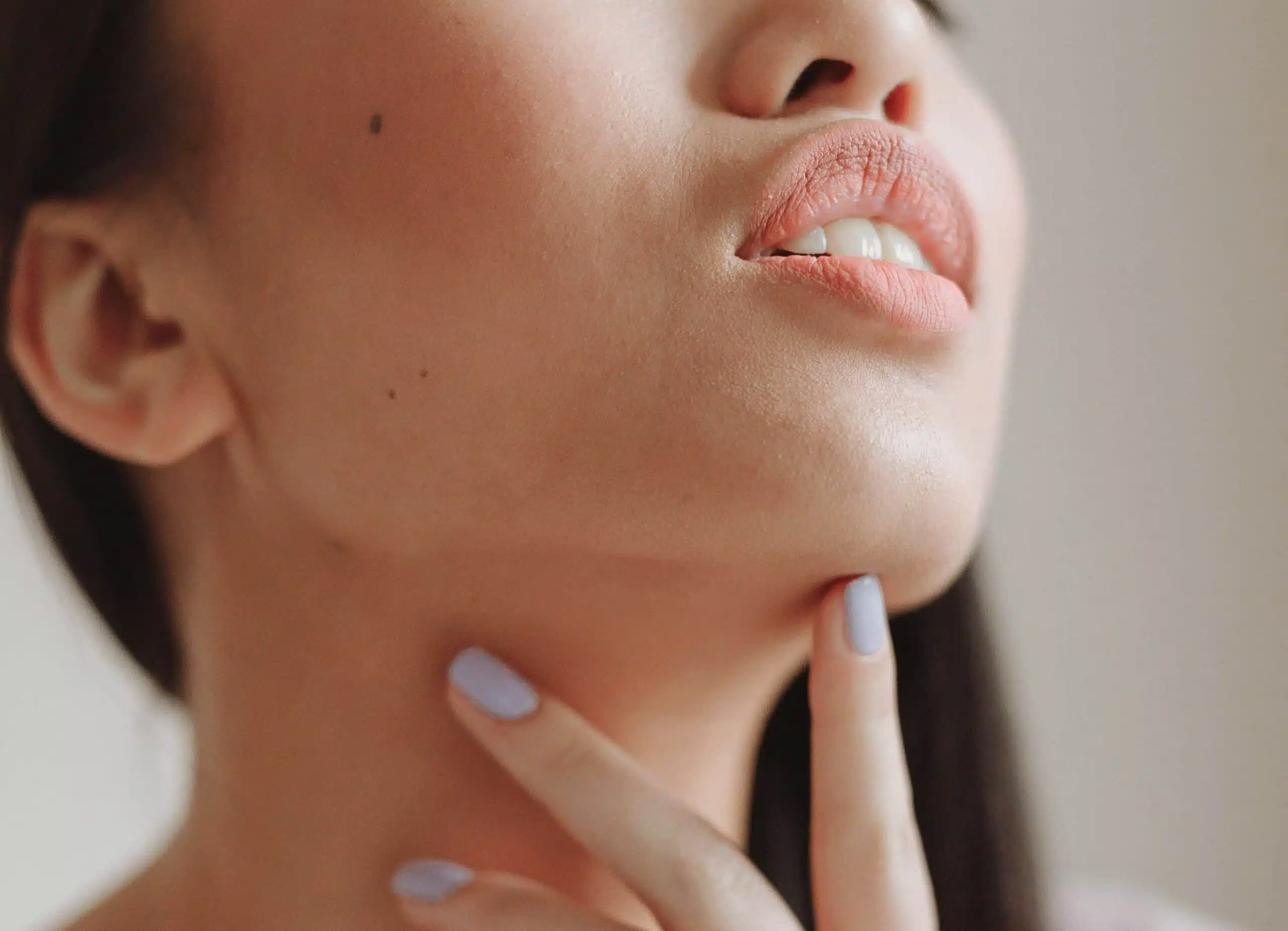 Epilation laser du menton à Paris | cabinet esthétique | Médecine esthétique | Dr Santini