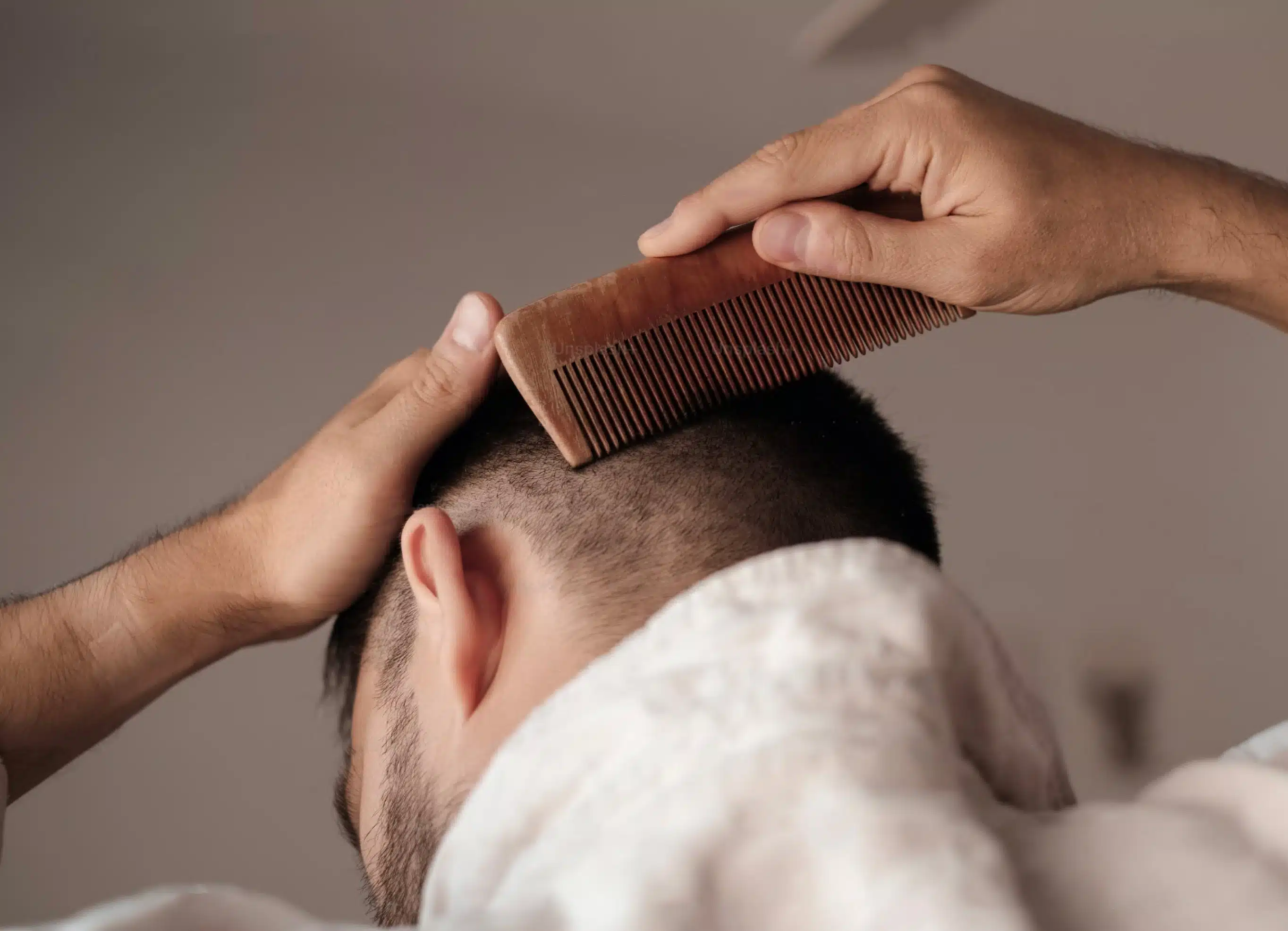 FUE à Paris | greffe de cheveux prix paris | Médecine esthétique | Dr Christelle Santini