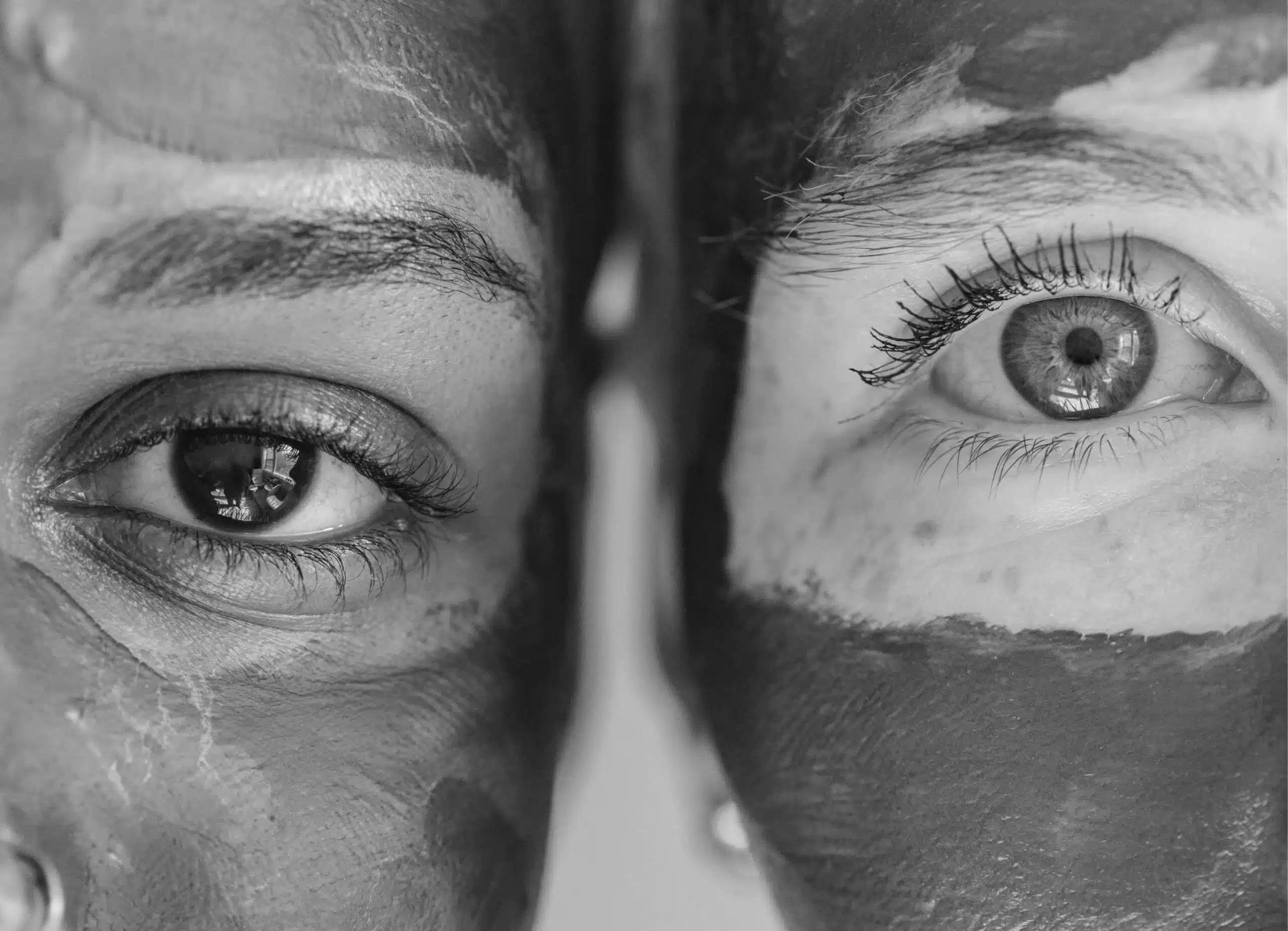 Laser Hollywood Spectra à Paris | cabinet de médecine esthétique | Médecine esthétique | Dr Santini