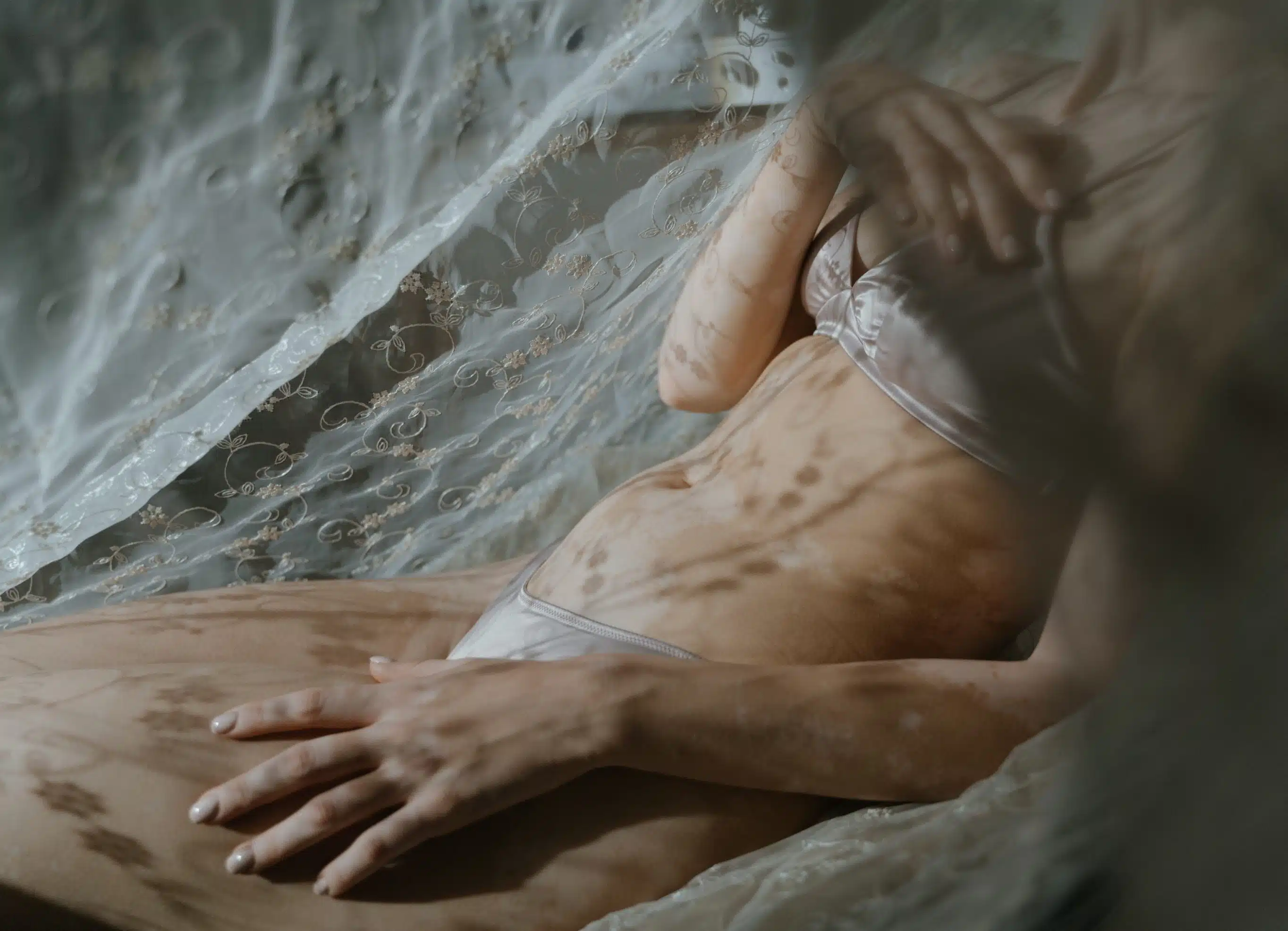 Reconstruction par lambeau DIEP à Paris | Chirurgie reconstructrice mammaire | Dr Christelle Santini