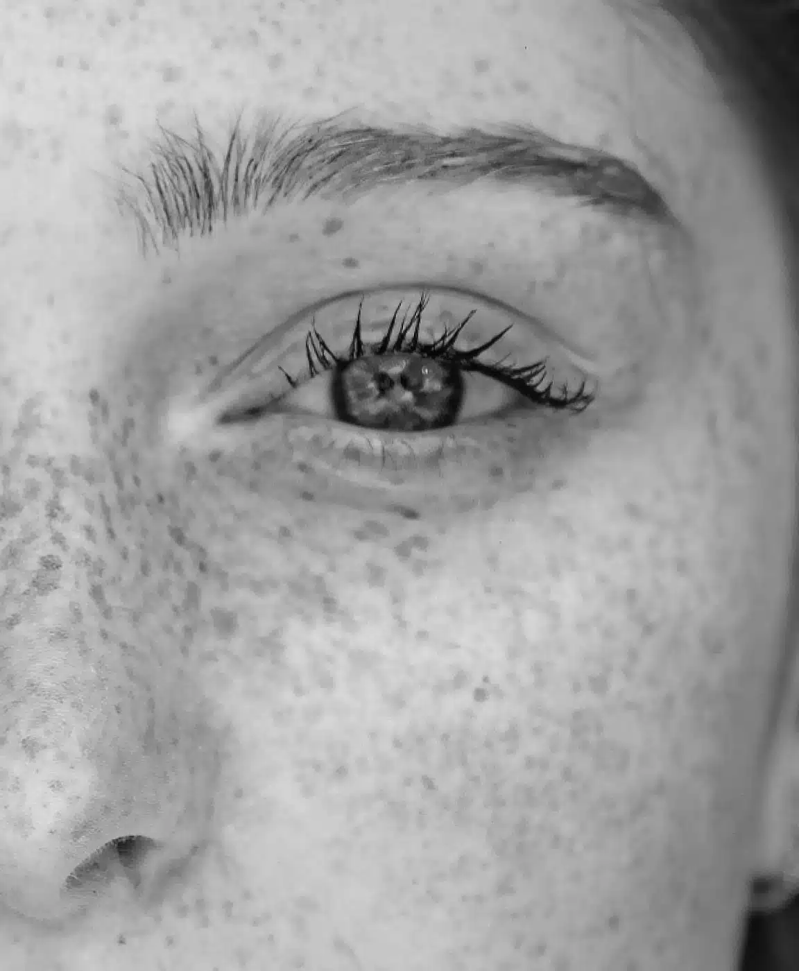 Photo rapprochee de l oeil d une jeune femme - blepharoplastie inferieure | Dr Santini Paris 16