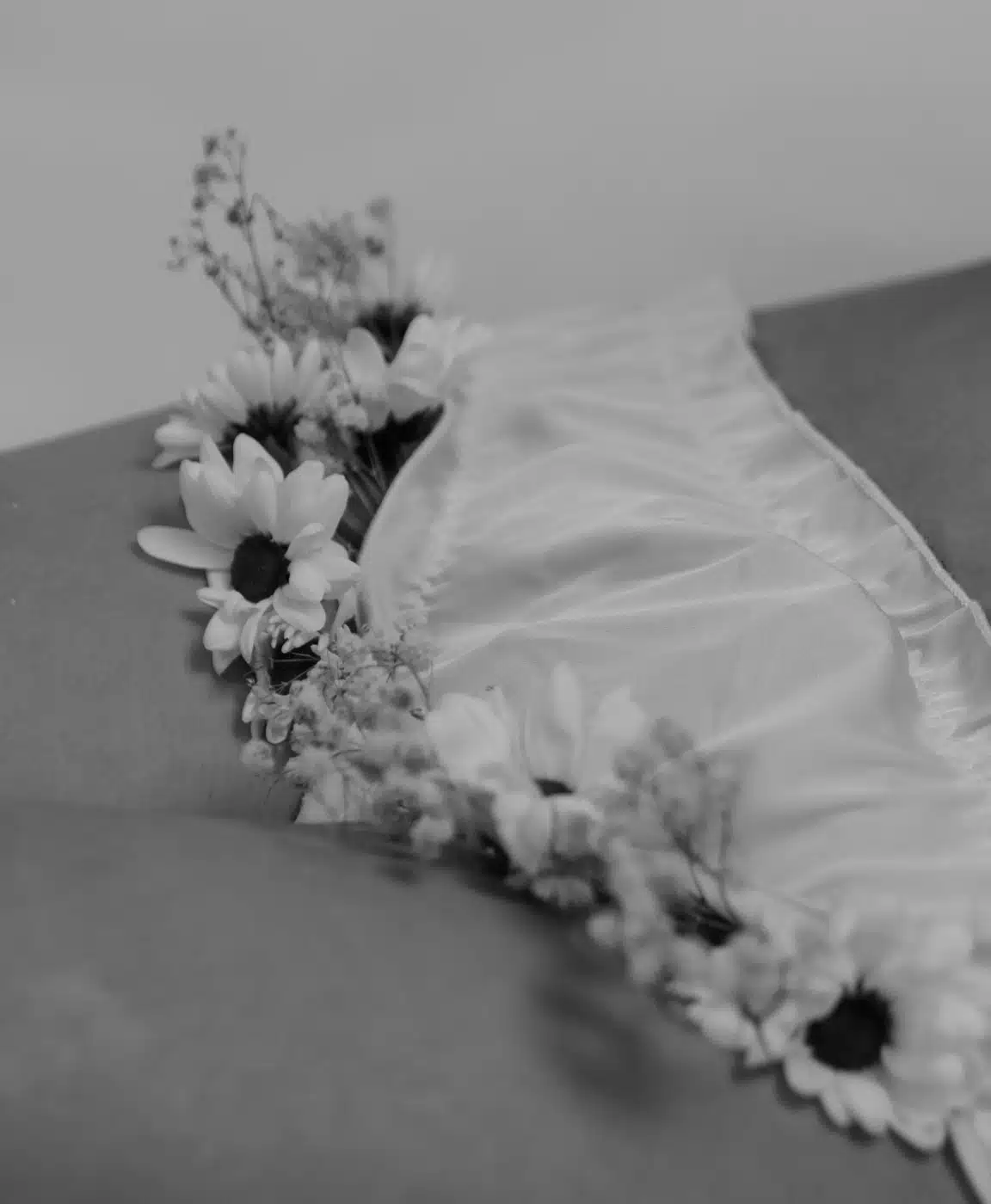 Photo rapprochee sur la culotte d une jeune femme - lipofilling grandes levres | Dr Santini Paris 16