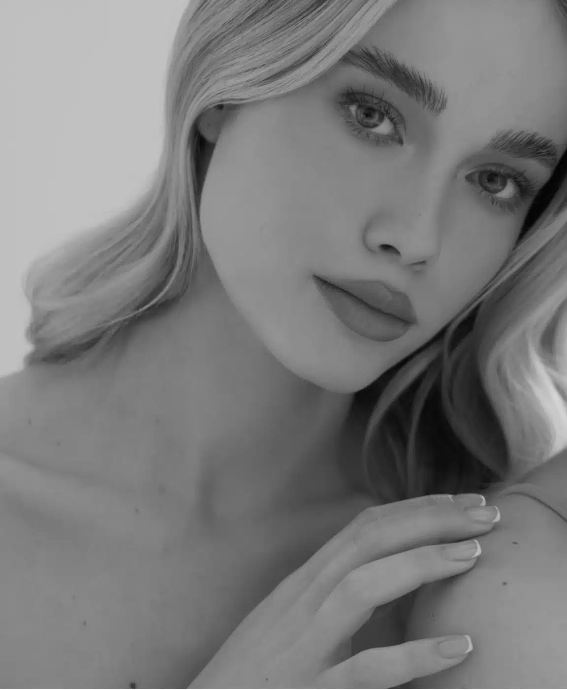 Photo du visage d une jeune femme - lipofilling visage | Dr Santini Paris 16