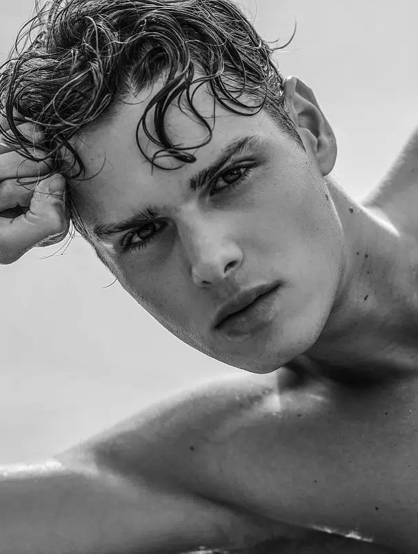 Photo stylisee d un jeune homme montrant son visage - greffe de cheveux | Dr Santini Paris 16