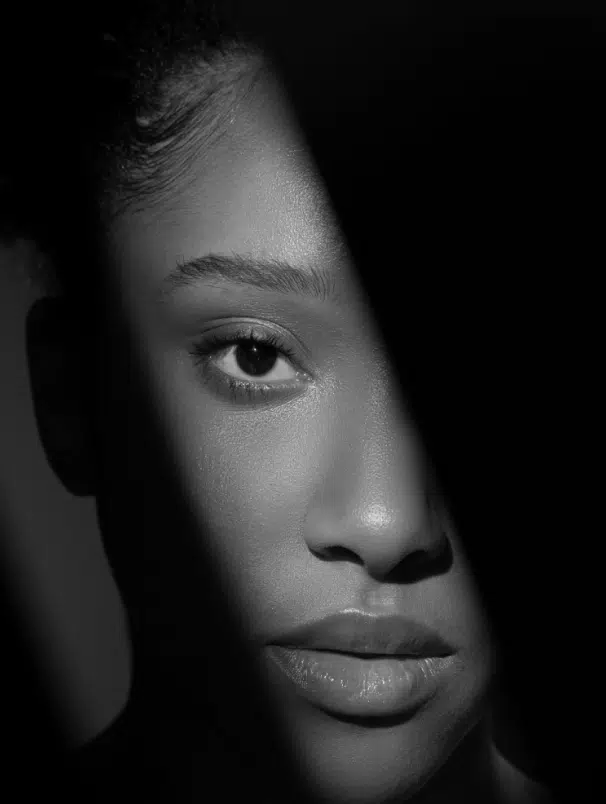 Photo stylisee du visage d une femme noire - acide hyaluronique | Dr Santini Paris 16