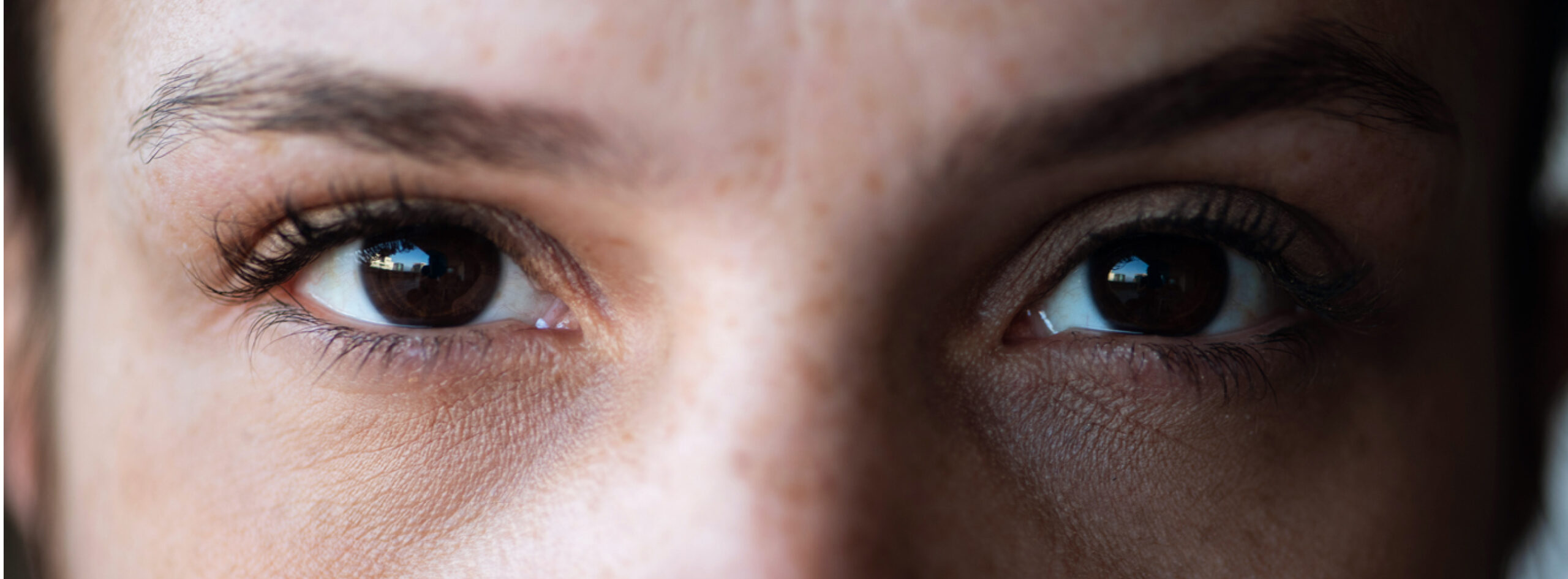 Soins regard severe