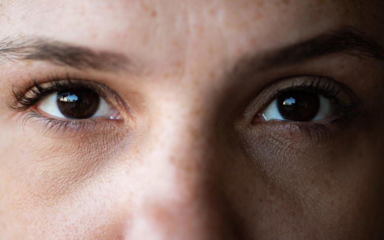 Soins regard severe