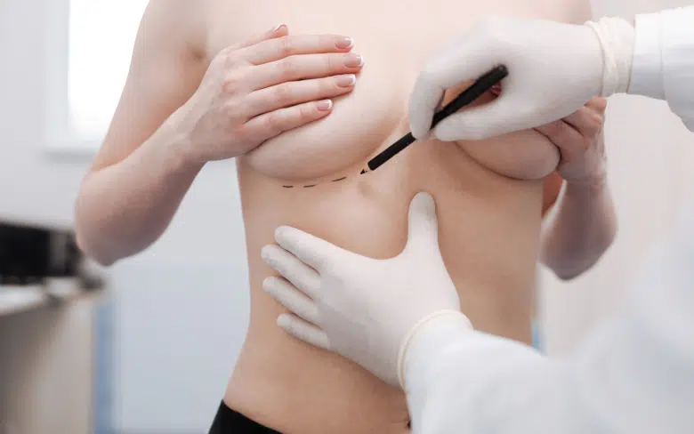 Augmentation mammaire